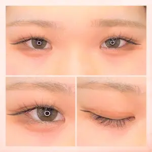 東京BELLEZZAクリニックの症例