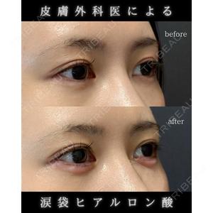 LA MER CLINIC 伊藤　整医師の症例