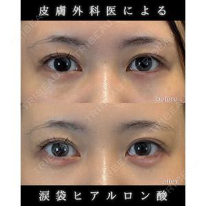 LA MER CLINIC 伊藤　整医師の症例