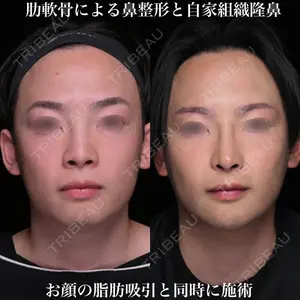 Zetith Beauty Clinic 銀座院 鉄 鑠医師の症例