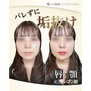 eクリニック 福岡院 伊藤 渉医師の症例
