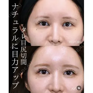 BIANCA銀座 南 寿美医師の症例