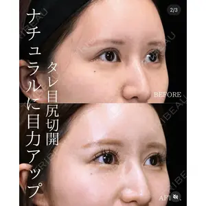 BIANCA銀座 南 寿美医師の症例