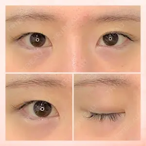 東京BELLEZZAクリニックの症例