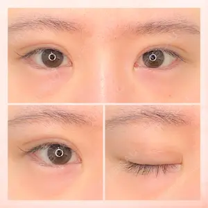 東京BELLEZZAクリニックの症例