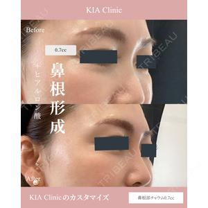 KIA CLINIC 心斎橋院 雲山　盛秀医師の症例
