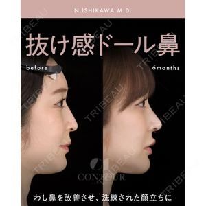 コントアクリニック 東京 石川 菜緒医師の症例