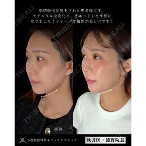 小倉美容外科ネビュラクリニック 浦野 正樹医師の症例