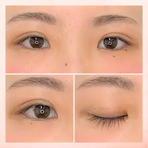 東京BELLEZZAクリニックの症例
