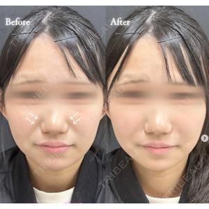 ルラ美容クリニック 札幌大通り院の症例
