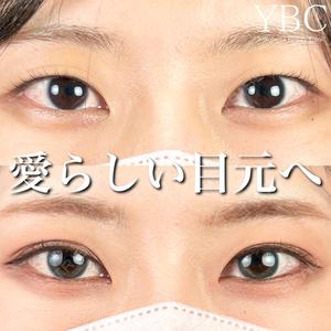 YBC横浜美容外科 池袋院 磯村 亮輔医師の症例