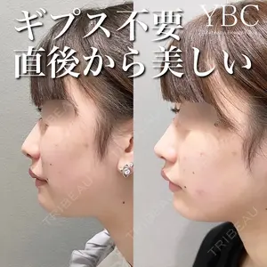 YBC横浜美容外科 池袋院 磯村 亮輔医師の症例