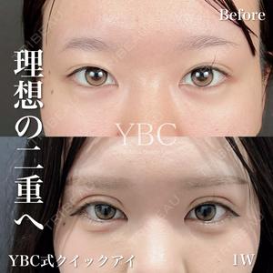 YBC横浜美容外科 立川院 塚原健汰医師の症例
