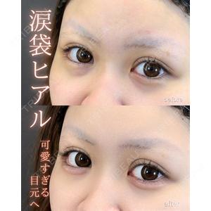 LA MER CLINIC 伊藤　整医師の症例