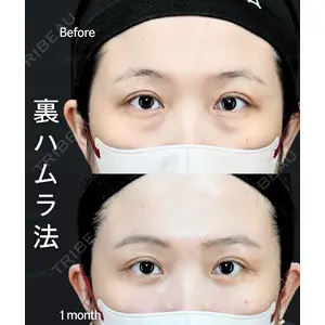 BIANCA銀座 藤橋 政尭医師の症例