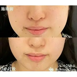 Bellefeel Clinic 代官山 兵藤 秀忠 医師の症例