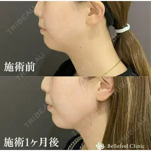 Bellefeel Clinic 代官山 兵藤 秀忠 医師の症例