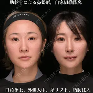Zetith Beauty Clinic 銀座院 鉄 鑠医師の症例
