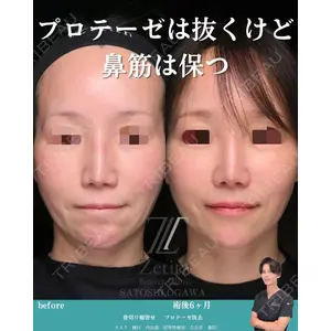 Zetith Beauty Clinic 銀座院 小川 悟史医師の症例