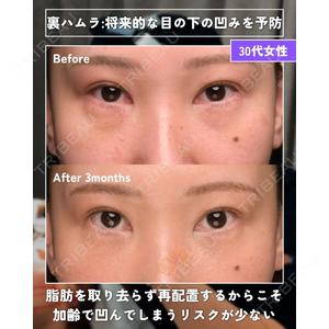 Zetith Beauty Clinic 銀座院 橘　澄医師の症例