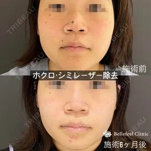 Bellefeel Clinic 代官山 兵藤 秀忠 医師の症例