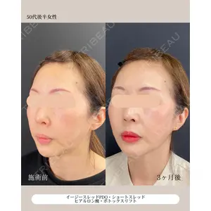 自由が丘ウェルエイジングビューティークリニック 福田 知佐子医師の症例