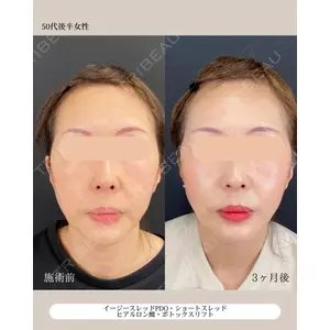 自由が丘ウェルエイジングビューティークリニック 福田 知佐子医師の症例