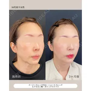 自由が丘ウェルエイジングビューティークリニック 福田 知佐子医師の症例