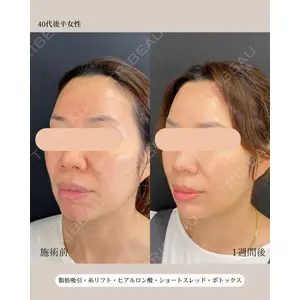 自由が丘ウェルエイジングビューティークリニック 福田 知佐子医師の症例