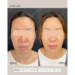 自由が丘ウェルエイジングビューティークリニック 福田 知佐子医師の症例