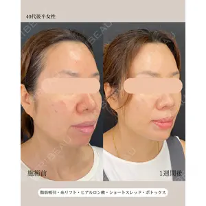 自由が丘ウェルエイジングビューティークリニック 福田 知佐子医師の症例