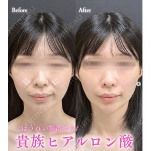 ルラ美容クリニック 札幌大通り院 能登 貴弘医師の症例