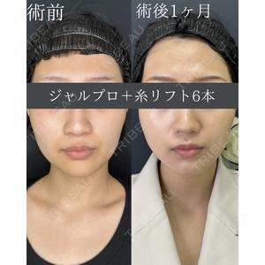 ルラ美容クリニック 名古屋本院 鶴田 佳雅医師の症例