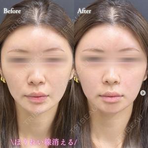 ルラ美容クリニック 札幌大通り院 能登 貴弘医師の症例