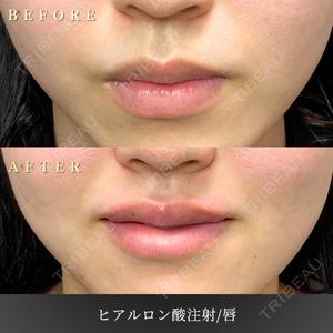 BiBiクリニック 山本 幸一郎医師の症例