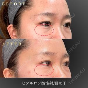 BiBiクリニック 山本 幸一郎医師の症例
