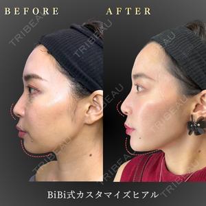 BiBiクリニックの症例