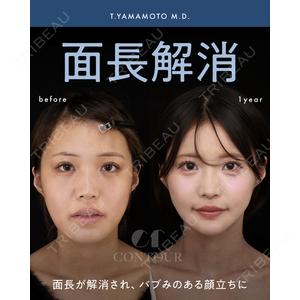 コントアクリニック 東京 山本 崇弘 医師の症例