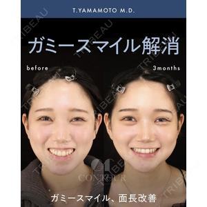 コントアクリニック 東京 山本 崇弘 医師の症例
