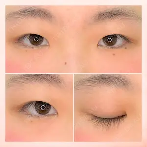 東京BELLEZZAクリニックの症例