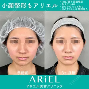 アリエル美容クリニック 大宮院 鈴木　桂介医師の症例