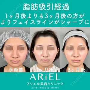 アリエル美容クリニック 大宮院 鈴木　桂介医師の症例