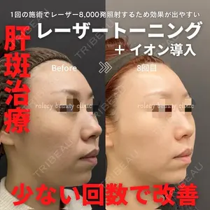 ロレシー美容クリニック 心斎橋駅前院 福留院長医師の症例