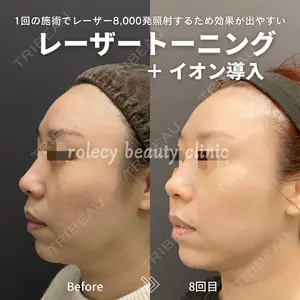 ロレシー美容クリニック 心斎橋駅前院 福留院長医師の症例