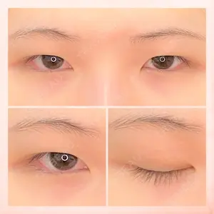 東京BELLEZZAクリニックの症例
