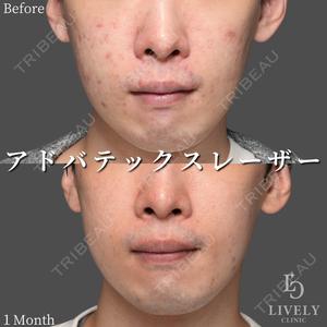 ライブリークリニック 浜松町院の症例