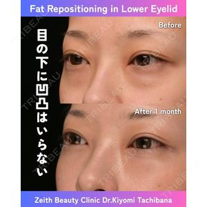 Zetith Beauty Clinic 銀座院 橘　澄医師の症例