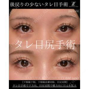 Zetith Beauty Clinic 大阪心斎橋院 楠本 拓哉医師の症例