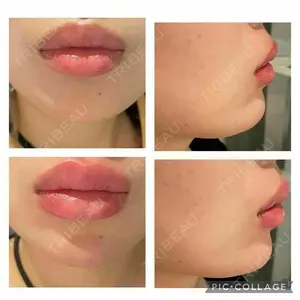 麻布十番クレールデンタルクリニック 藤田 亜樹医師の症例