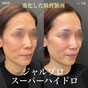 ルラ美容クリニック 名古屋栄院 / ルラスキンクリニック 名古屋栄院 関戸 優医師の症例